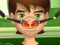 게임 Ben 10 Nose Doctor