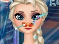 게임 Frozen Elsa Nose Doctor