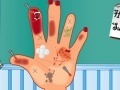 게임 Hand Surgery