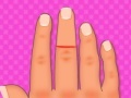 게임 Finger surgery