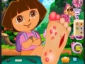 게임 Dora Foot Injuries