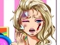 게임 Elsa Face Surgery