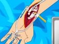 게임 Arm surgery 2