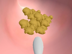 게임 Earwax Clinic