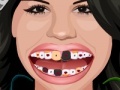 게임 Selena Gomez Perfect Teeth 